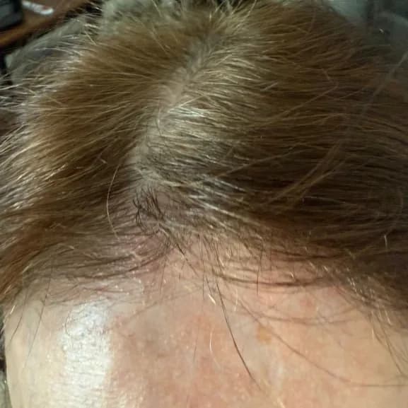After