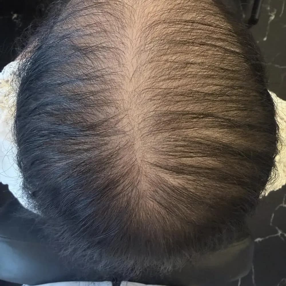 After