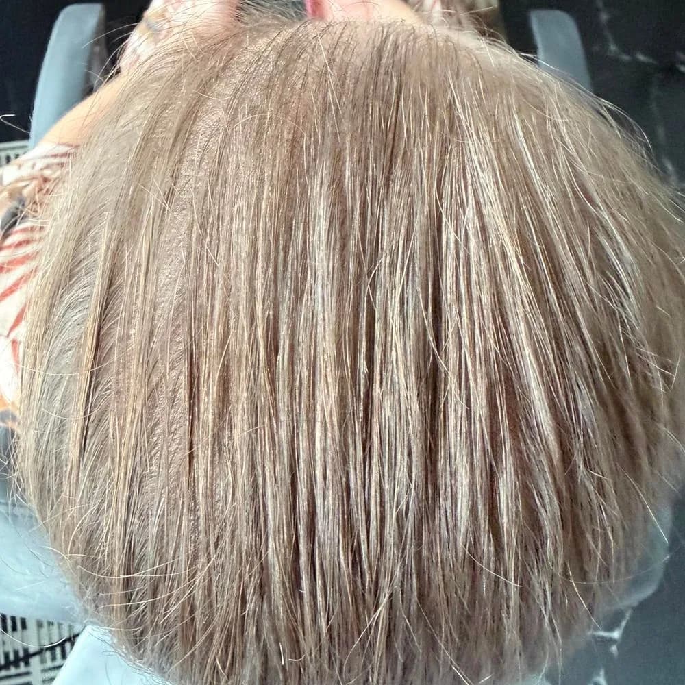 Before
