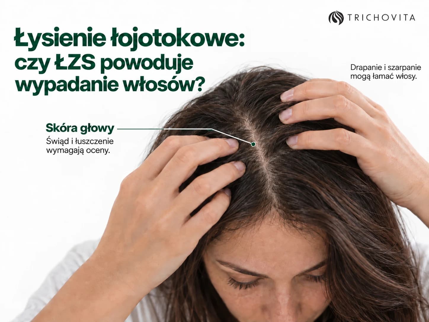 Łysienie łojotokowe: czy ŁZS powoduje wypadanie włosów?