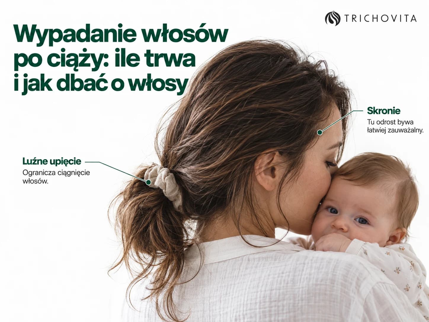 Wypadanie włosów po ciąży: ile trwa i jak dbać o włosy